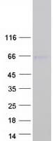 Human SOX8 Protein (Recombinant Myc-DDK (Flag))