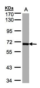 IHC-plus™ PLK1 / PLK-1 Antibody