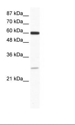 ZFP91 Antibody (aa96-145)