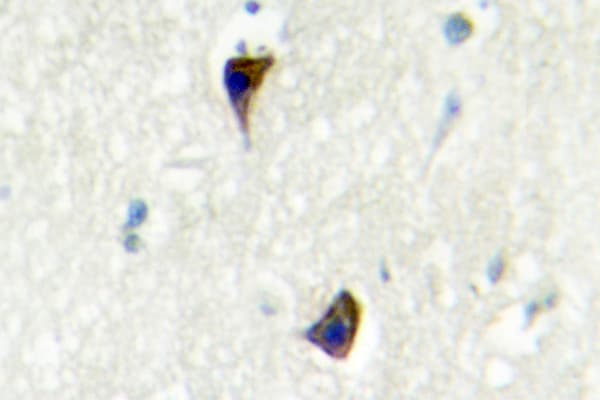 ADRA1A Antibody (Gln365)