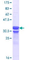Human GPR158 Protein (Recombinant GST, N-terminus)