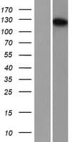 TDRD7 Protein (Over-Expression Lysate Myc-DDK (Flag))