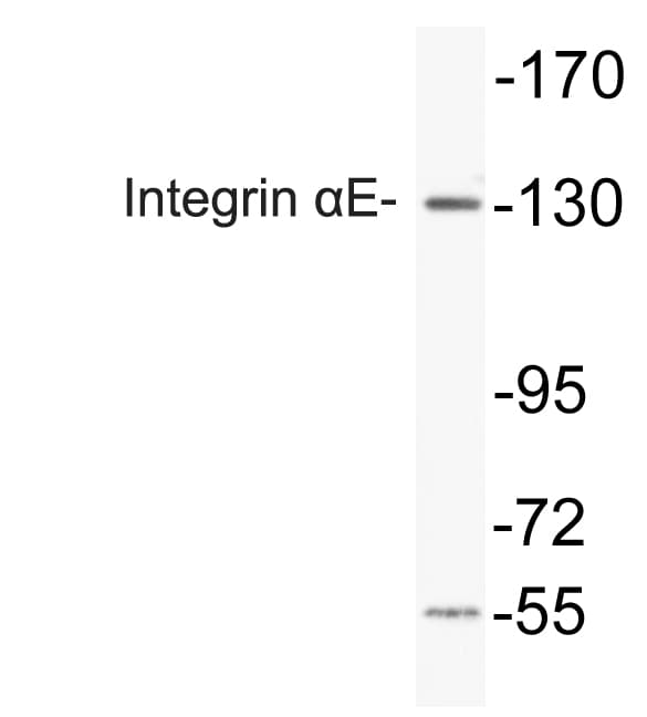 ITGAE / CD103 Antibody (aa131-180)