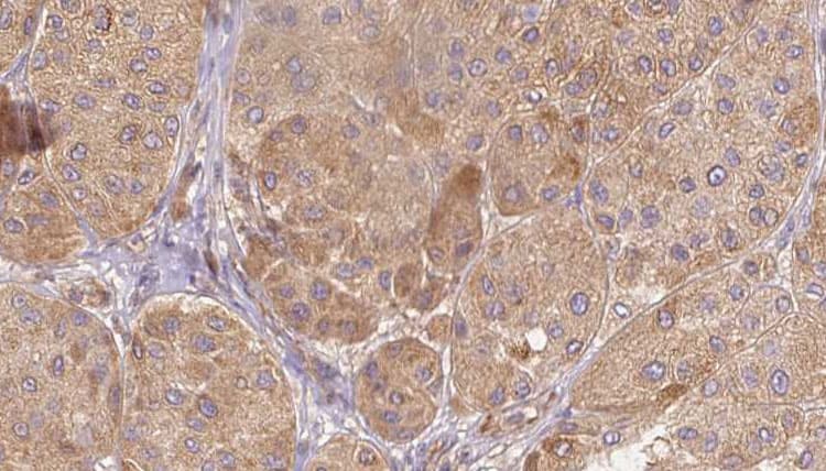 SEMG1 Antibody
