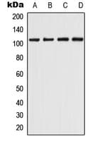 CHERP Antibody (Internal)