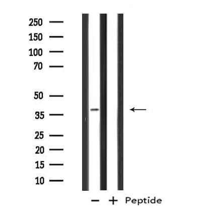 GTF3A Antibody