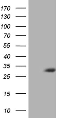 ASB13 Antibody (aa76-278, clone OTI4A1)