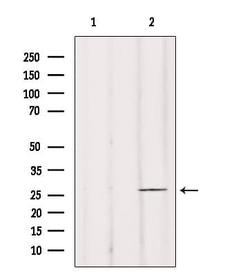 BRMS1 Antibody