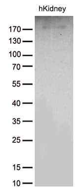 ACE / CD143 Antibody (aa642-1230, clone OTI2G5)