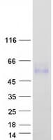 Human LRTM2 Protein (Recombinant Myc-DDK (Flag))