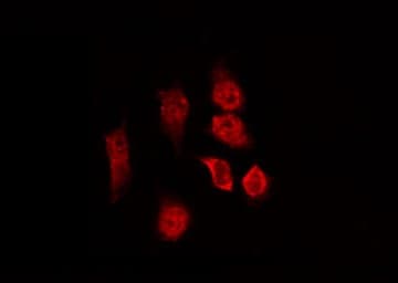 SPDL1 / CCDC99 Antibody