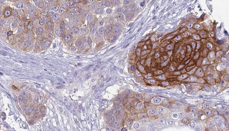 SLC4A2 / AE2 Antibody