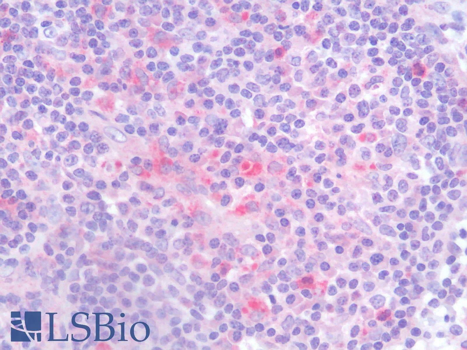 IHC-plus™ TIGIT Antibody