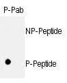 RB1 / Retinoblastoma / RB Antibody (phospho-Ser811)