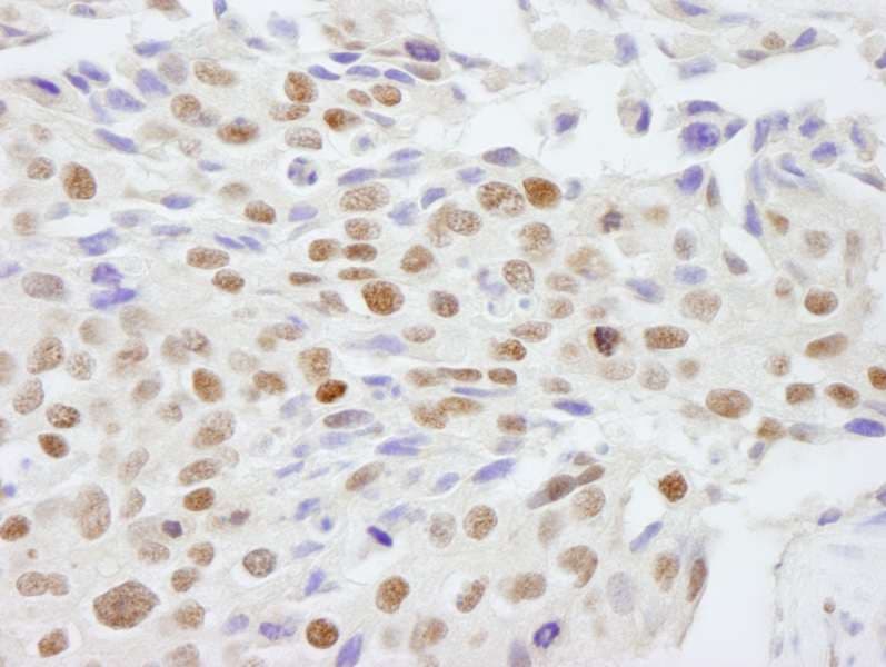 SAFB2 Antibody (aa175-225)