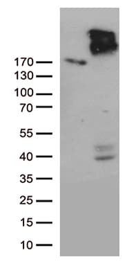 Monoclonal Mouse anti-Human ABCC2 / MRP2 Antibody (clone OTI5C3, Carrier-free, aa1256-1545, IHC, WB)
