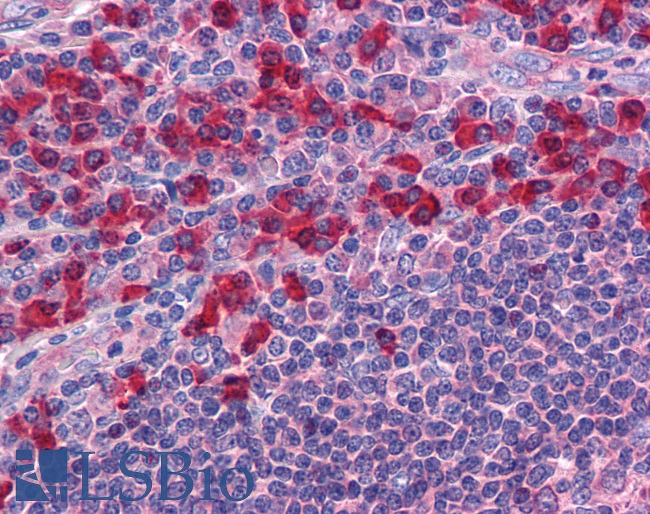 IHC-plus™ TLR7 / CD287 Antibody (aa465-483)
