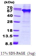 Human TDG / Thymine DNA Glycosylase Protein (Recombinant His)