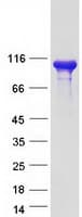 Human CMTR1 / FTSJD2 Protein (Recombinant Myc-DDK (Flag))