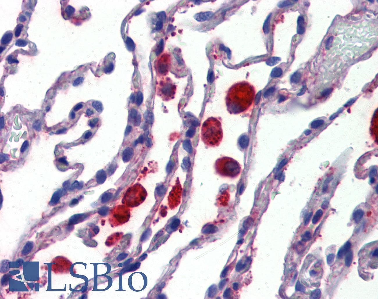 IHC-plus™ Polyclonal Rabbit anti-Human C14orf1 Antibody (Internal, IHC)