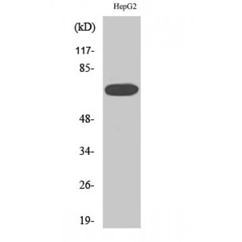 MAP3K3 / MEKK3 Antibody (70-150 aa, Internal)