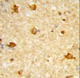 GBTS1 / DIRAS1 Antibody (aa109-136)