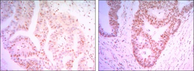 CTG-B45d / THAP11 Antibody (clone 3F3)