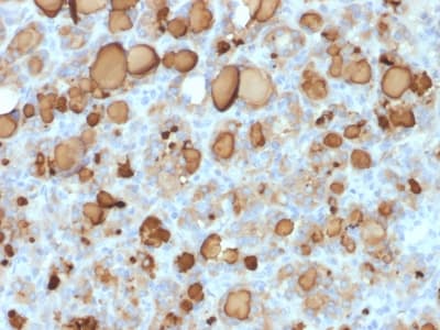 TG / Thyroglobulin Antibody (clone rTGB24, Azide-free, Carrier-free)