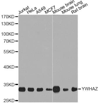 Polyclonal Rabbit anti-Human YWHAZ / 14-3-3 Zeta Antibody (IF, WB)