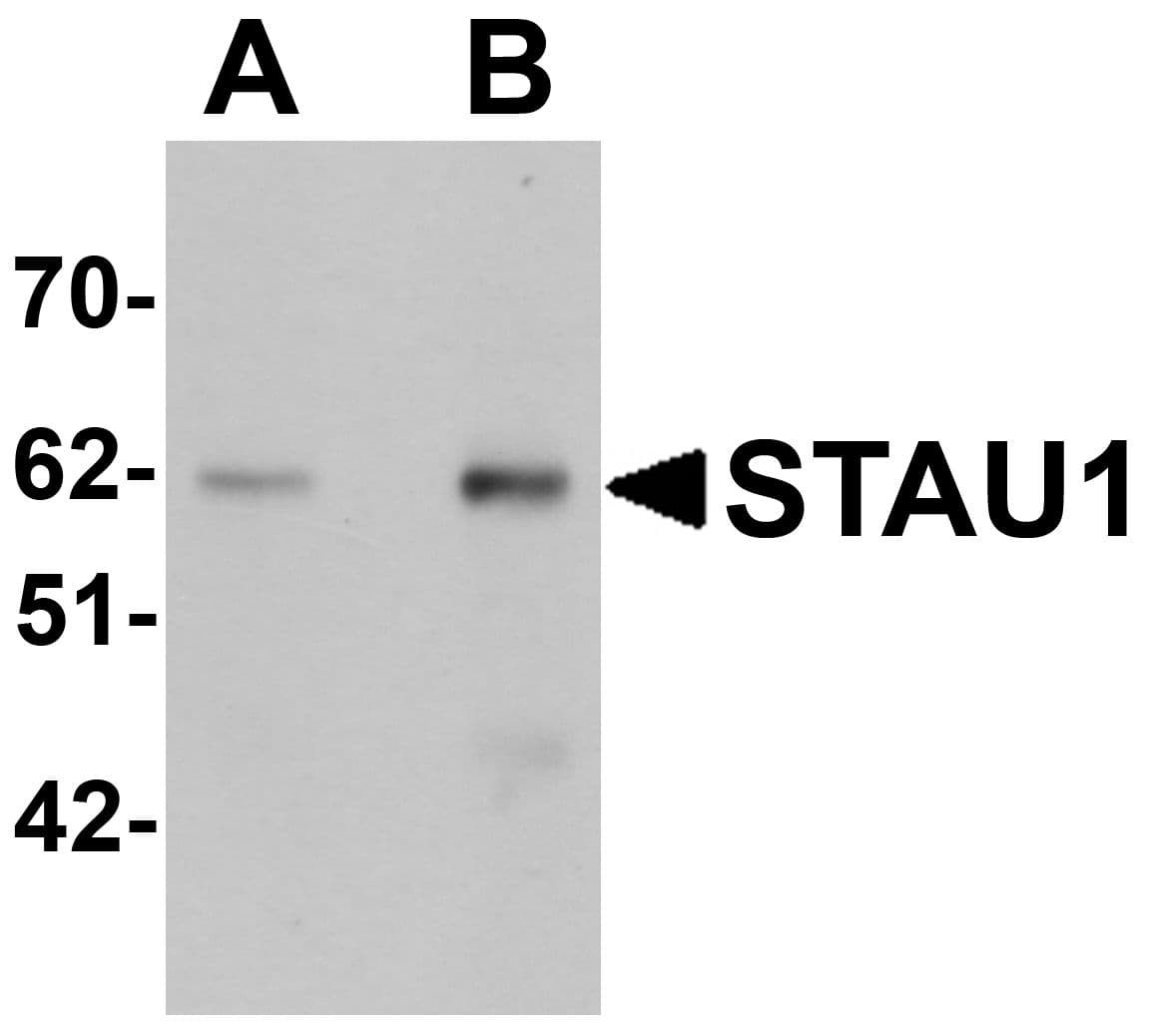 IHC-plus™ STAU1 / Staufen Antibody
