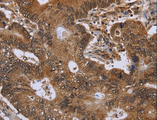FHIT Antibody
