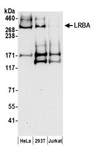 LBA / LRBA Antibody (aa1125-1175)