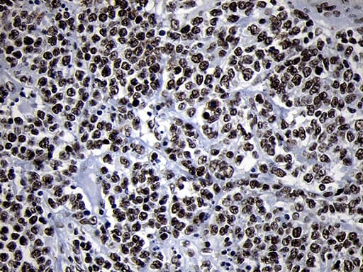 SMC1A / SMC1 Antibody (aa889-1016, clone OTI5A1)