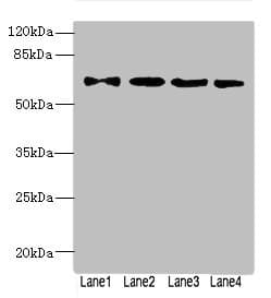 Polyclonal Rabbit anti-Human ZNF324 / ZF5128 Antibody (IHC, WB)