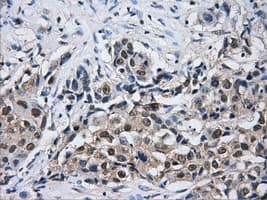 HDAC10 Antibody (clone OTI6G5)