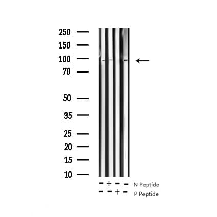 CTTN / Cortactin Antibody (phospho-Tyr421)