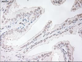 Monoclonal Mouse anti-Human TNNI3 / Cardiac Troponin I Antibody (clone OTI3G2, IHC, WB)