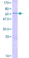Human DIMT1L Protein (Recombinant GST)