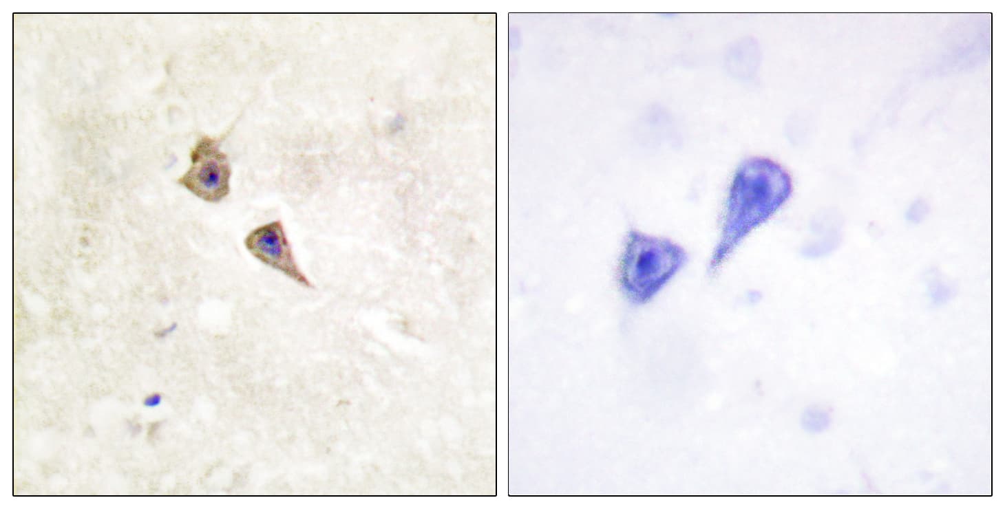 IFNAR1 / IFNAR Antibody (phospho-Tyr466)