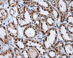 RIP1 / RALBP1 Antibody (clone OTI6E8)