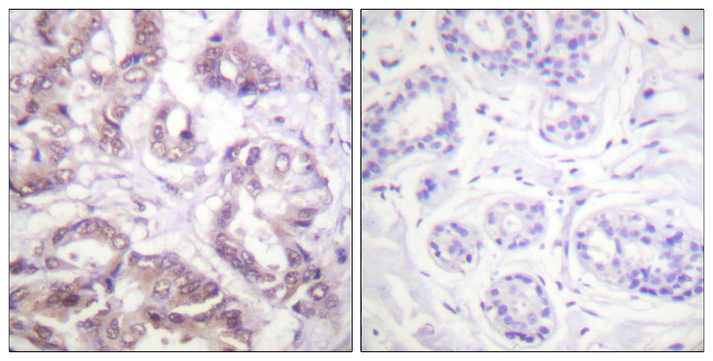 Polyclonal Rabbit anti-Human BIRC5 / Survivin Antibody (aa11-60, IHC)