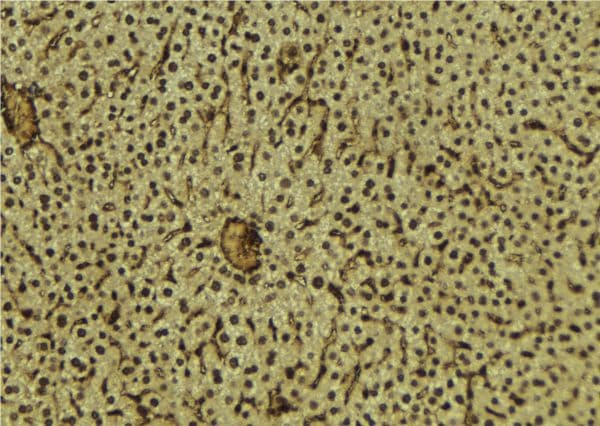 NUP88 Antibody