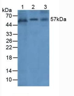 ANGPT1 / Angiopoietin-1 Antibody (aa284-452)