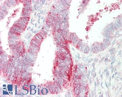 IHC-plus™ HUNK / B19 Antibody (aa238-287)