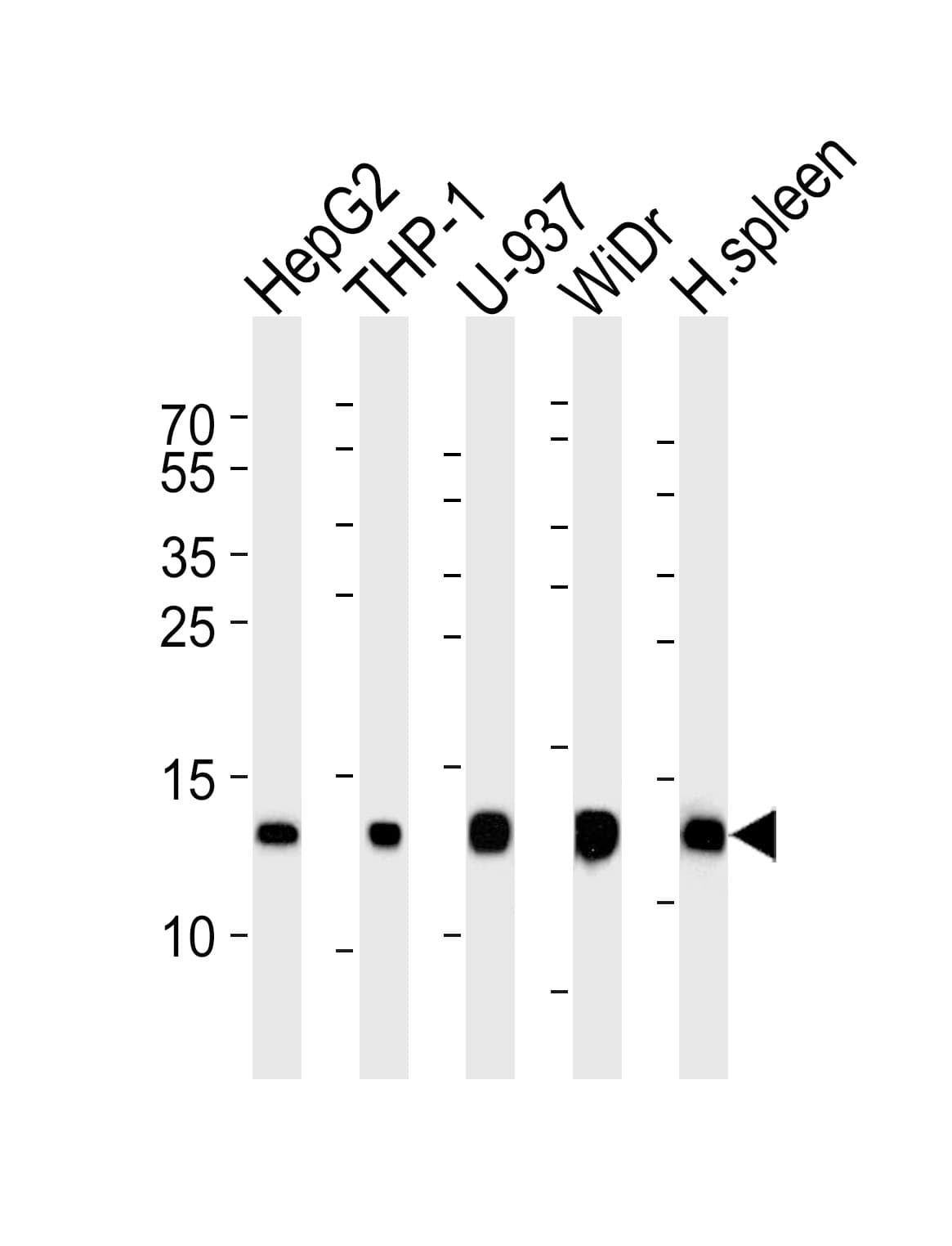 LYZ / Lysozyme Antibody (aa119-154)