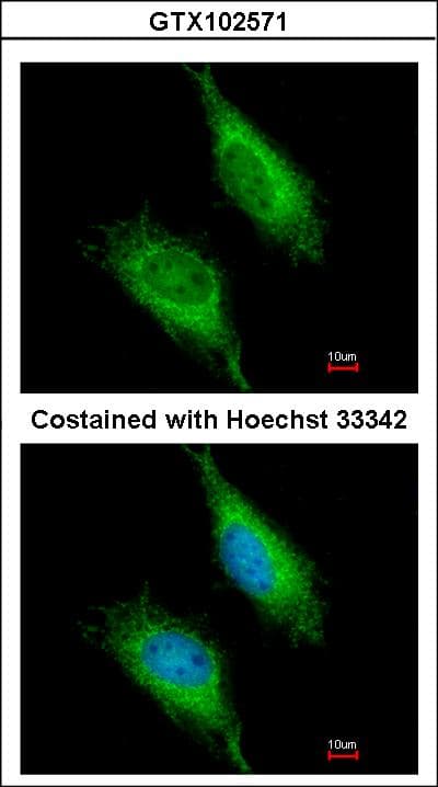 Polyclonal Rabbit anti-Human FASTK / FAST Antibody (aa346-549, IHC, WB)
