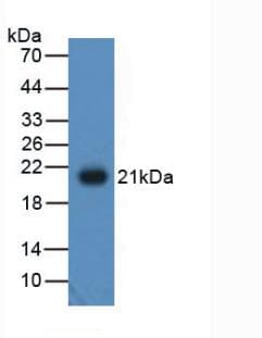Adiponectin Antibody (aa19-244)