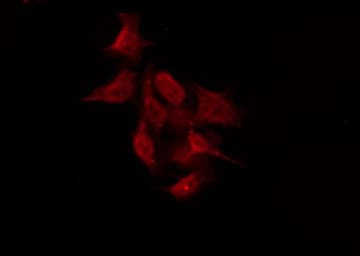 GPR158 Antibody
