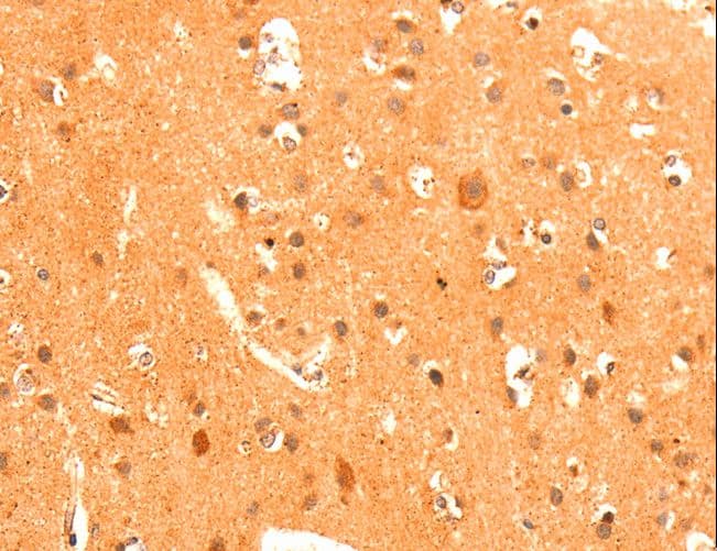 GRM3 / MGLUR3 Antibody