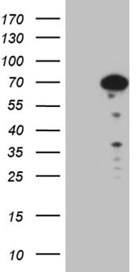 SF1 Antibody (aa1-276, clone OTI4C9)